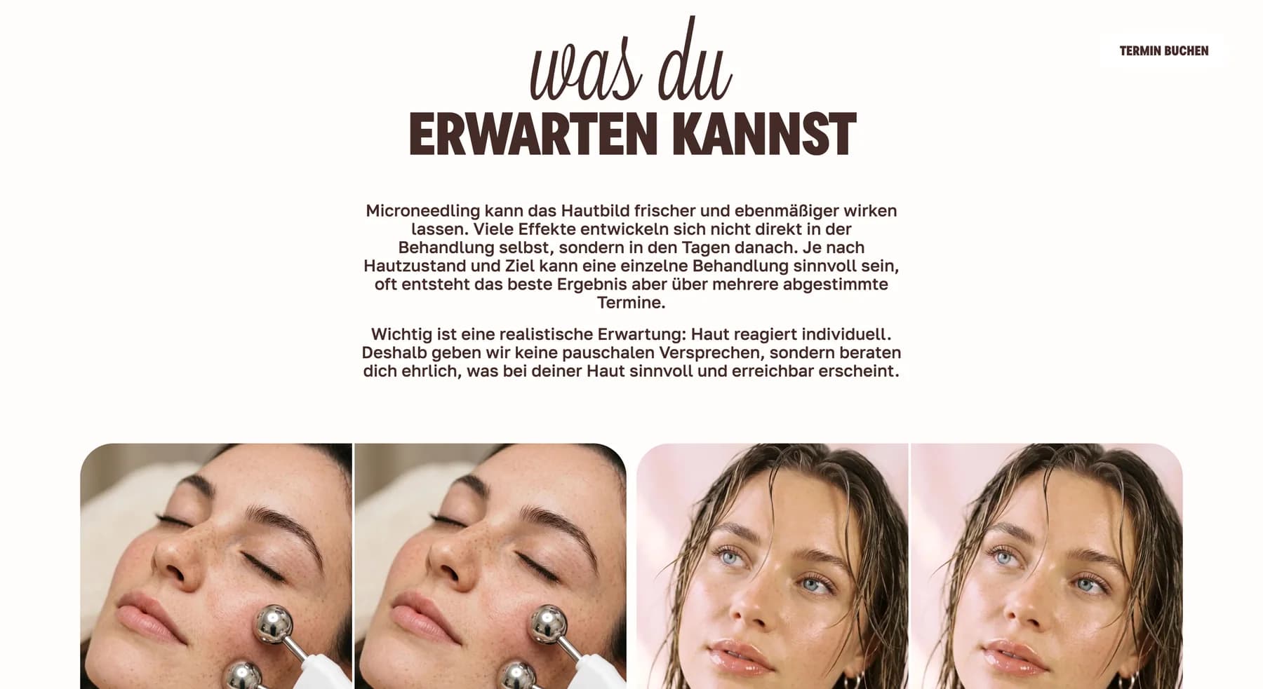 Editorial WunderDerm microneedling page section with diverse portrait photography
